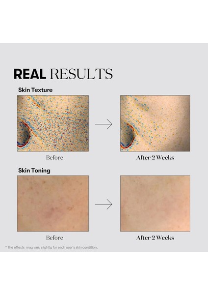 Tx Toning Essence 1000 Shot 30ML Parlak Cam Cilt Yüzü Için