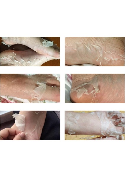 Ayak Peeling Maskesi Nasır, Ölü Deri Temizleyici, Egzama Giderici, Nemlendirici Özellik, Lavanta Yağı ve C Vitamini Içerir, Doğal Aktif Maddeler modelleri