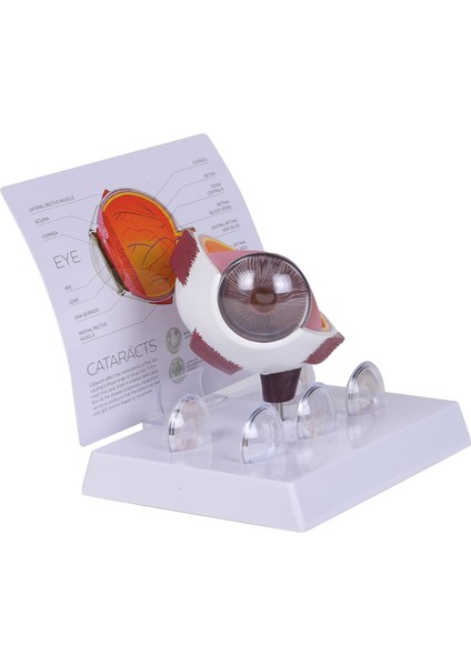 Katarakt Göz Modeli - Göz Maketi