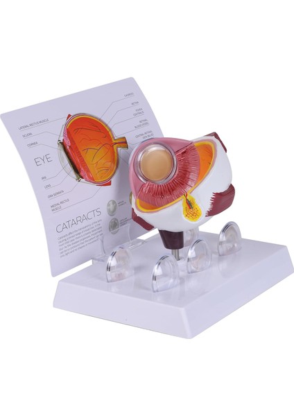 Katarakt Göz Modeli - Göz Maketi fırsatları