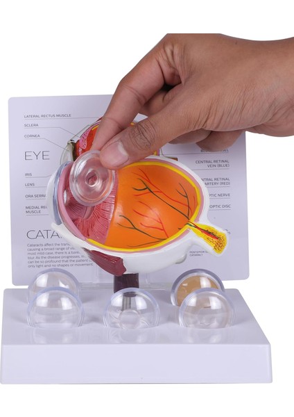Katarakt Göz Modeli - Göz Maketi indirimleri