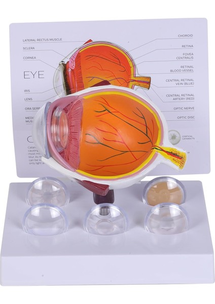 Katarakt Göz Modeli - Göz Maketi