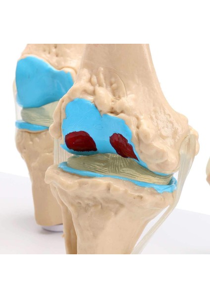 Diz Eklemi Modeli Osteoporoz Durumu Modelleri - Diz Eklemi Maketi indirimleri