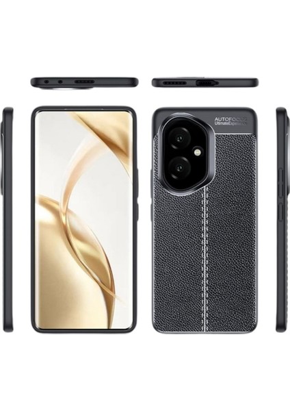 Honor 400 Uyumlu Silikon Kılıf Deri Desenli Darbe Emici Autofocus Tam Koruma Kapak