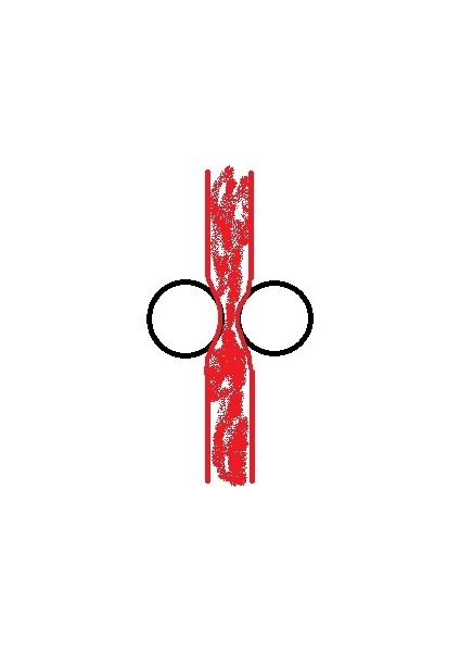 Yeni Fare Tekerleği Için Yumuşak Jant Rapoo (Plastik Aparattır!!!)