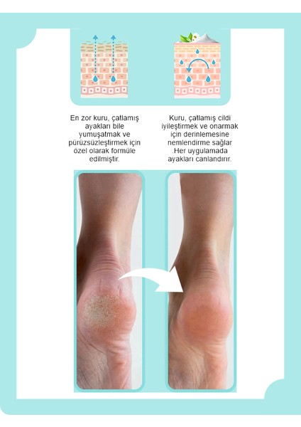Ayak Bakım ve Topuk Çatlak Kremi 100 ml + 100 ml 2'li Set Anında Etkili indirimleri