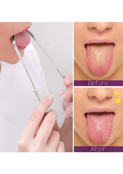 Paslanmaz Çelik Ikili Dil Temizleme Seti, Kötü Koku Önleyici-Ağız Hijyeni Dil Bakım Seti modelleri