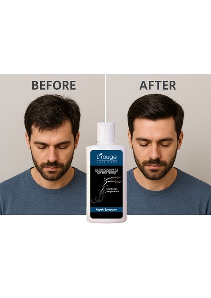 Kepek Önleyici Kepek Şampuanı Çift Etkili fırsatları