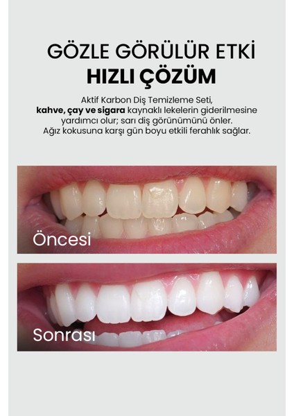 Organik Aktif Karbonlu Diş Beyazlatma Tozu – Çay, Kahve & Sigara Lekesi Karşıtı, 50 g modelleri