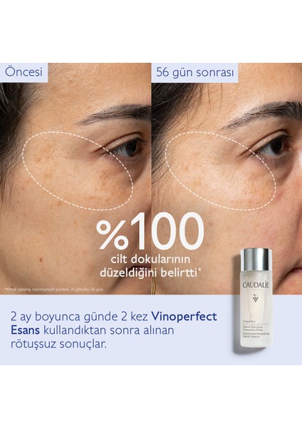 Vinoperfect Glikolik Asitli Leke Karşıtı ve Aydınlatıcı Yüz Serumu 100 ml – Karma Cilt Tipleri İçin Etkili Bakım fırsatları
