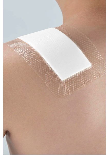 Post-Op Ameliyat Sonrası Dikiş,yara ve Kesiler Için-Steril,sugeçirmez,hassas Cilt Dostu Medikal Örtü