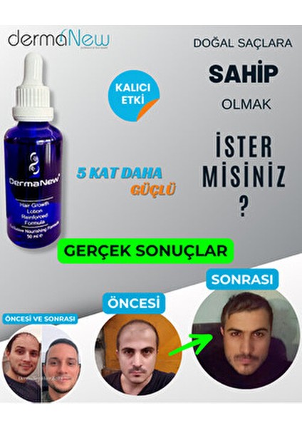 Sac Bakim Seti - Sac Bakimi Sac Serum ve Yagi - Sac - Sac Gurlestırıcı / 1 Adet Serum Roller