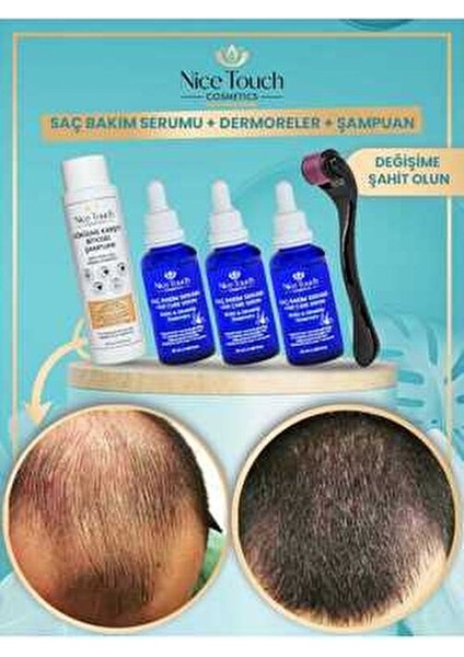 3 Adet Saç Bakım Serumu Dökülme Karşıtı Şampuan Dermoreler Gürleştirici Saç Cıkaran Serum Set