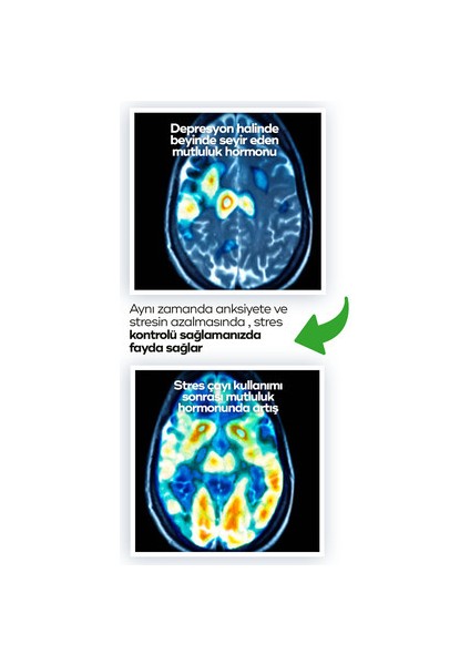 Anadolu Köyleri Tanzim Birliği Stres Karşıtı Bitki Çayı 75 gr Bd Detox Bromelain Çay Hediyesiyle modelleri