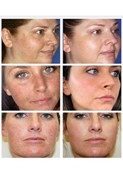 Kanza Cilt Beyazlatıcı Leke Giderici Sabun modelleri