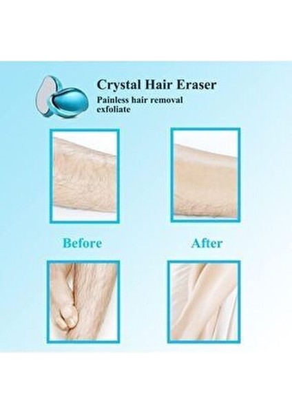 epilasyon aleti tüy silgisi tüy alıcı fiziksel kristal epilatör ağrısız kristal epilatör modelleri