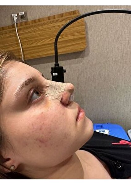 footlıne foot healthly Burun Deliği Şekillendirici(1)(7)Nostril Retainer modelleri