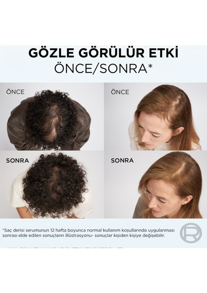 Elseve Growth Booster Dökülme Karşıtı Saç Derisi Serumu 102ML indirimleri