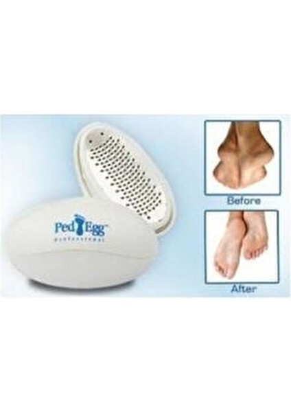 Ayak Törpüsü Beyaz Renkli Kullanım Amacıyla Tırnak Bakımı İçin Özel Tasarım modelleri