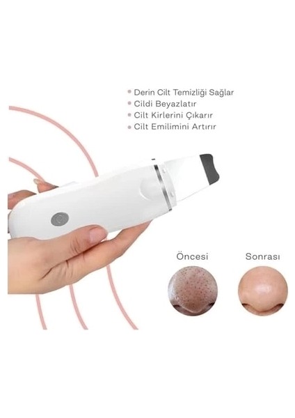 Ultrasonik Spatula Yüz Akne Giderici Siyah Nokta Temizleme Cihazı fırsatları