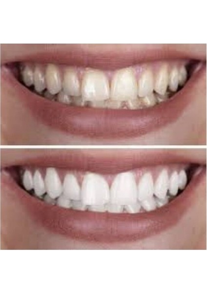 Diş Beyazlatıcı Temizleme ve Parlatma Pastası 5'li Set Florürlü Leke Giderici ABD Üretimi modelleri