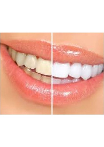 Diş Beyazlatıcı Temizleme ve Parlatma Pastası 5'li Set Florürlü Leke Giderici ABD Üretimi fırsatları