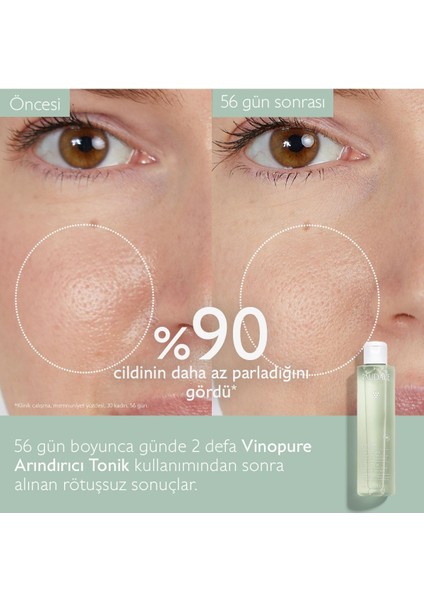 Akne Karşıtı Arındırıcı Tonik Vinopure 200 ml indirimleri