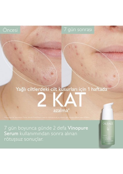 Vinopure Akne Karşıtı Salisilik Asitli Arındırıcı Yüz Serumu 30 ml fırsatları