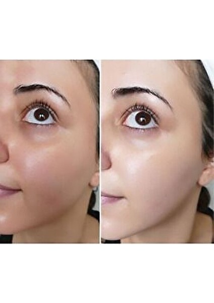 Cilt Beyazlatıcı Sabun Özel Formül ile Cilt Aydınlatıcı Etki Sağlar fiyatları