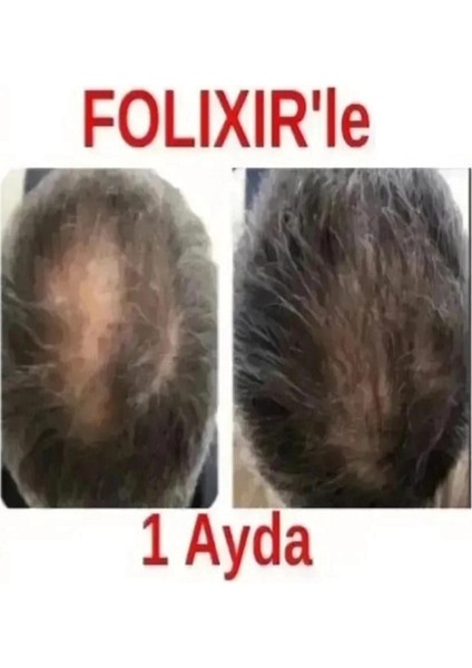 Saç Serumu 60 ml Yoğun Terapi Doğal Bitkisel İçerikli Dökülme Karşıtı Günlük Bakım fırsatları