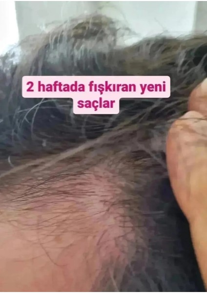 Saç Serumu 60 ml Yoğun Terapi Doğal Bitkisel İçerikli Dökülme Karşıtı Günlük Bakım