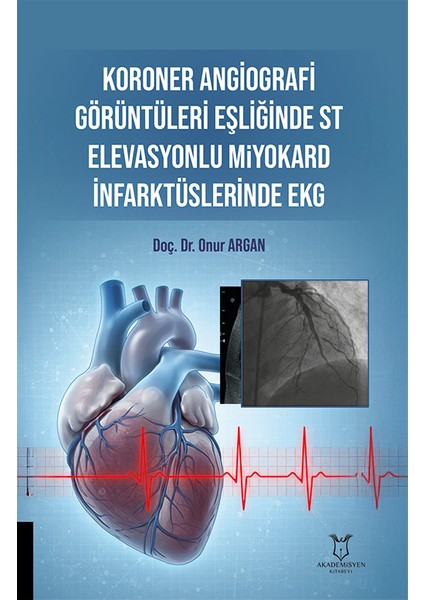 Koroner Angiografi Görüntüleri Eşliğinde St Elevasyonlu Miyokard Infarktüslerinde Ekg