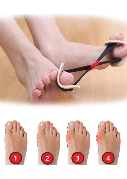 Ayak Baş Parmak Kemik Düzeltici Egzersiz Lastiği modelleri