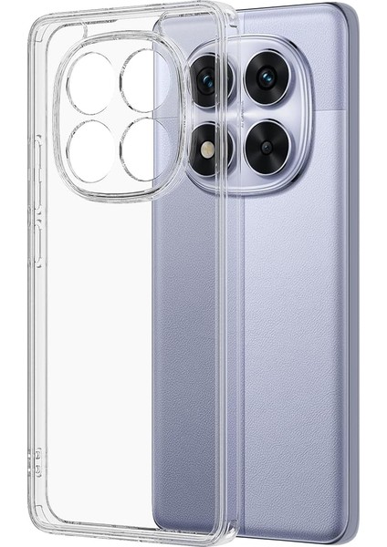 Xiaomi Redmi Note 14 Pro 4g Uyumlu Sararmaz Hoparlör Toz Korumalı Sert Şeffaf Kılıf