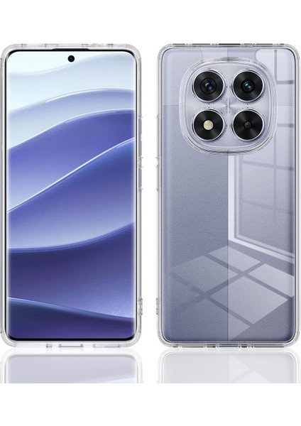 Xiaomi Redmi Note 14 Pro 4g Uyumlu Sararmaz Hoparlör Toz Korumalı Sert Şeffaf Kılıf fiyatları