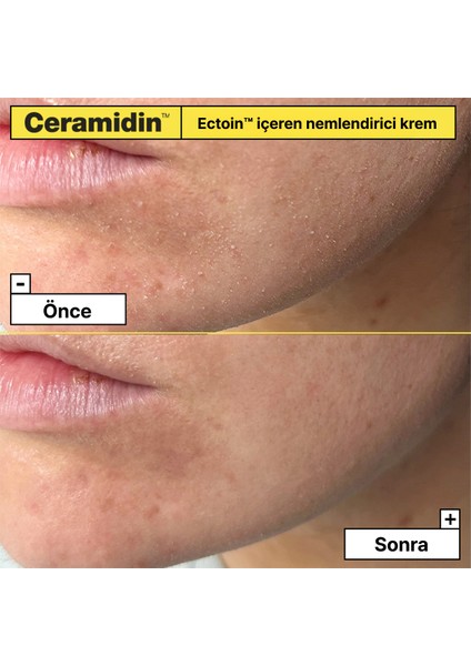 Dr. Jart Ceramidin - Ektoin Içerikli Nemlendirici Krem 50ML/1.7FLOZ fırsatları