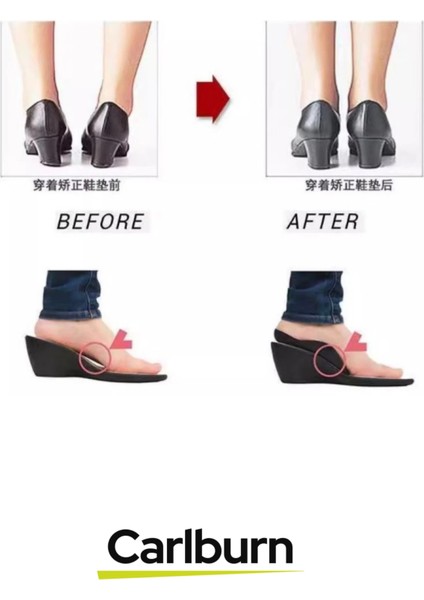 Özel Üretim Yumuşak Silikon Yürüyüş Konfor Artırıcı Esnek Düz Taban Düzeltici Topuk Yastığı modelleri