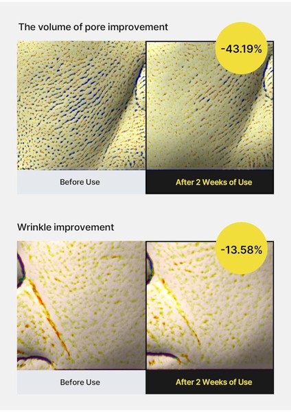 Retinol Shot Tightening Serum 30ML (Vionine)