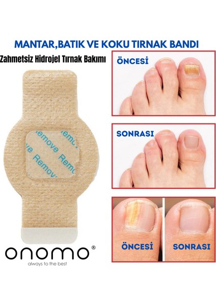 Health Tırnak Mantarı Bandı, Hidrojel Tırnak Bakımı 5 Adet