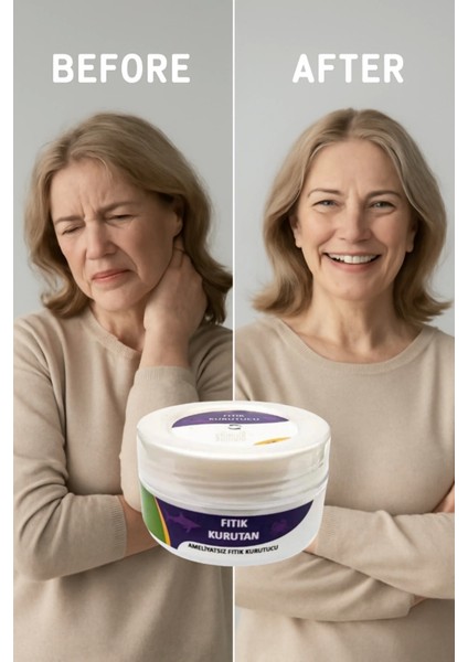 Fıtık Kurutan Krem 50 ml