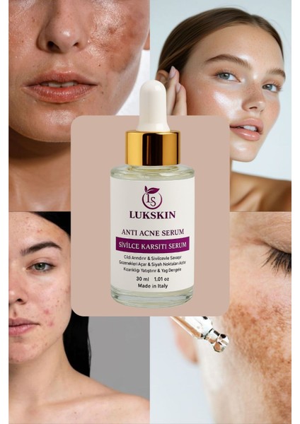 Akne ve Karşıtı Serum - Akne Kurutucu - Siyah Nokta Leke Iz Akne Komedon Karşıtı fırsatları