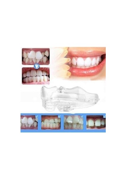 Diş Silikon Ortodontik Parantez Ağız Tepsisi Parantez D2 Orta