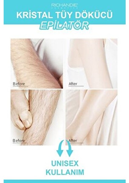 Crystal Eraser Epilasyon Aleti Tüy Silgisi Tüy Alıcı Fiziksel Kristal Tüy Dökücü Epilatör Mavi fiyatları