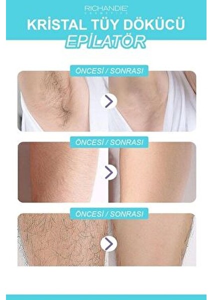 Crystal Eraser Epilasyon Aleti Tüy Silgisi Tüy Alıcı Fiziksel Kristal Tüy Dökücü Epilatör Mavi fırsatları