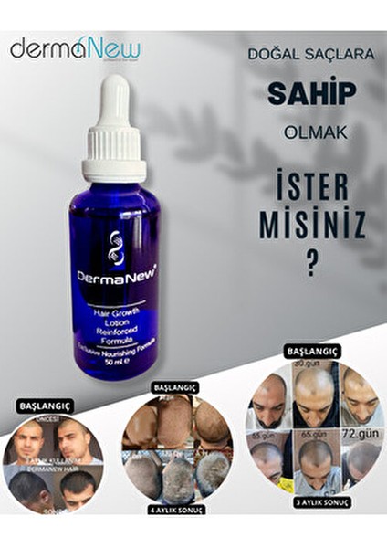 Saç Gürleştirici Serum - Dökülme Karşıtı Şampuan Roller Hediyeli /5X50ML