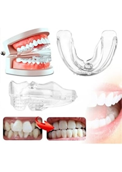 Ortodontik Parantez Eğri Diş Düzeltme Seti D1 Yumuşak D2 Orta D3 Sert modelleri