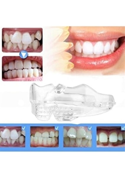 Ortodontik Parantez Eğri Diş Düzeltme Seti D1 Yumuşak D2 Orta D3 Sert fırsatları