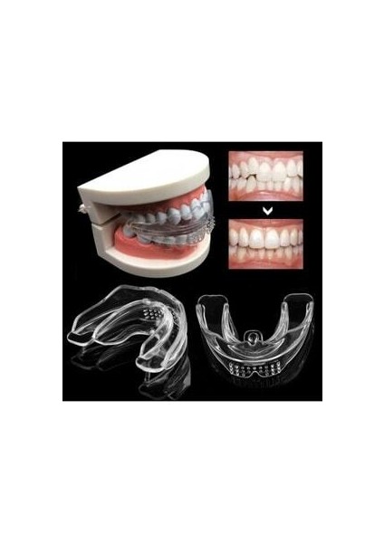 Ortodontik Parantez Eğri Diş Düzeltme Seti D1 Yumuşak D2 Orta D3 Sert indirimleri