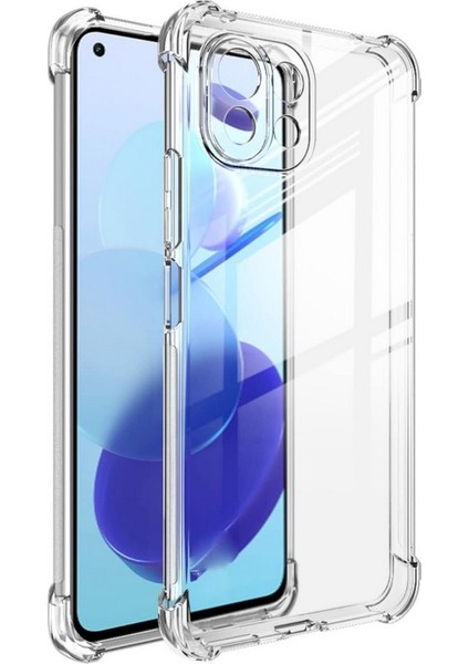 Xiaomi Mi 11 Lite Darbe Emici Şeffaf Silikon Kılıf