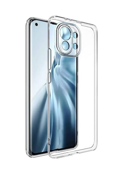 Xiaomi Mi 11 Lite Lux Seri Premium Şeffaf Silikon Kılıf
